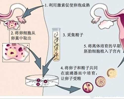 供卵生儿子-三代试管婴儿的成功率是多少